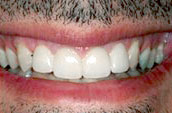 Dr. Dorgan Dentistry - Kennett Square - After Photo