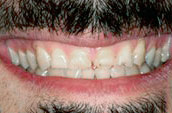 Dr. Dorgan Dentistry - Kennett Square - Before Photo